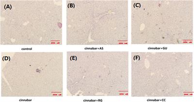 Traditional Chinese medicine Zhusha Anshen Wan: protective effects on liver, kidney, and intestine of the individual drugs using 1H NMR metabolomics